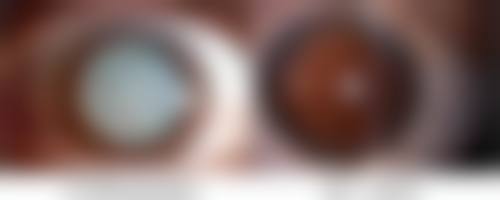 邯郸卫校附属医院整形外科收费价格表