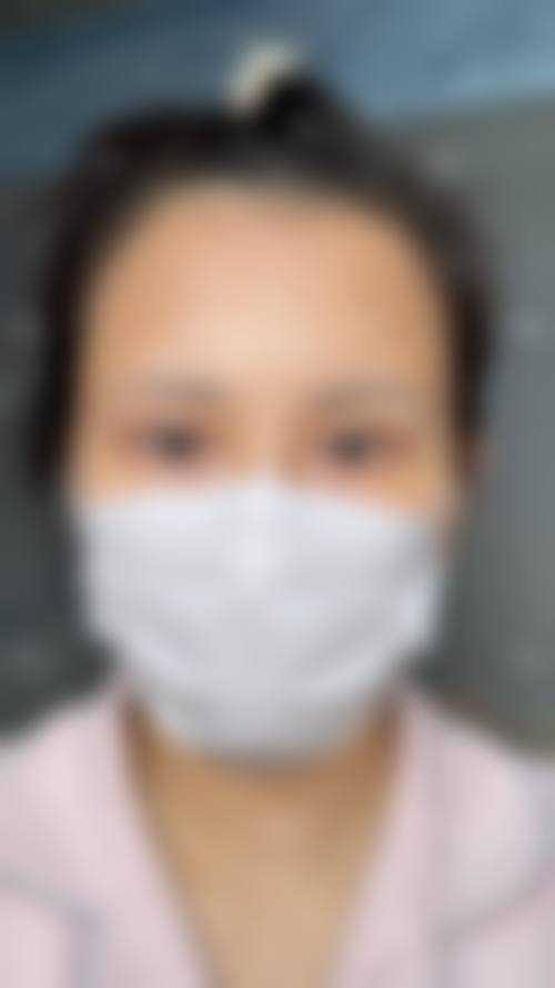 叶锋医生项目收费价格