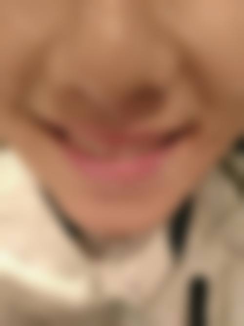 叶锋医生预约挂号