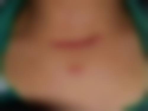 杨国虎医生技术优势