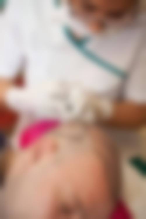 石家庄大麦微针植发特色诊疗项目与技术优势