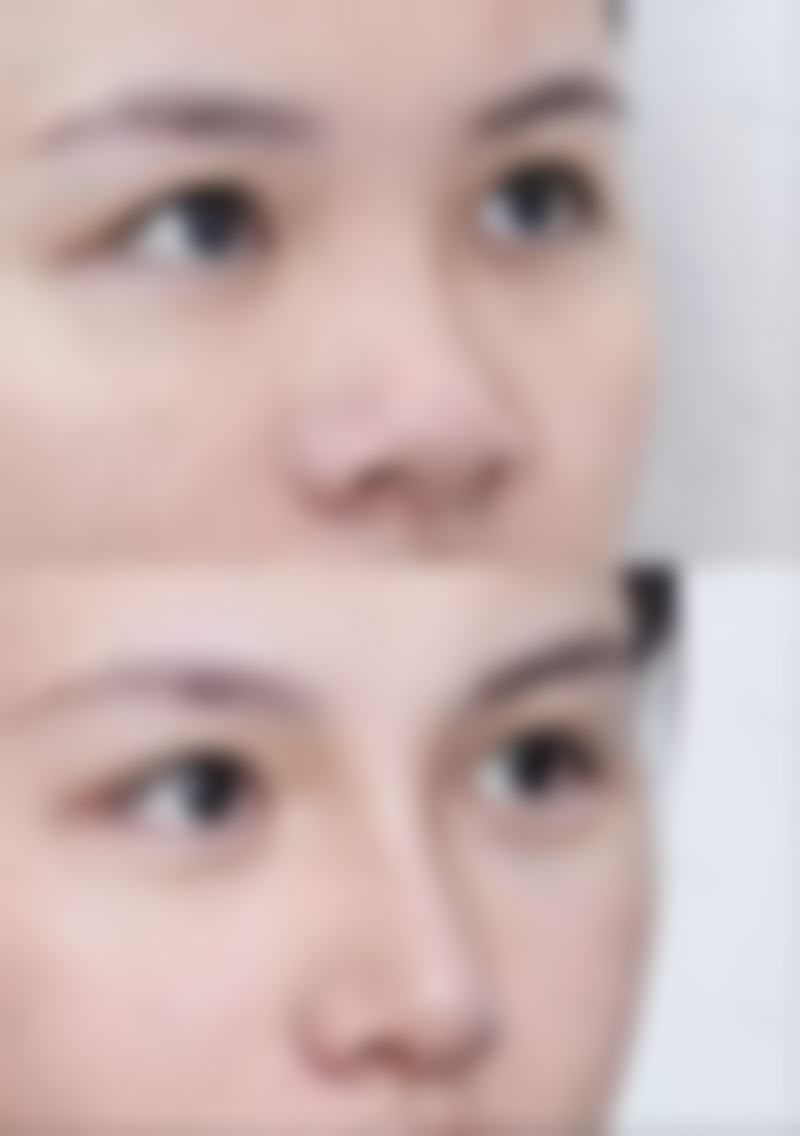 东莞美之善医疗美容诊所收费价格表