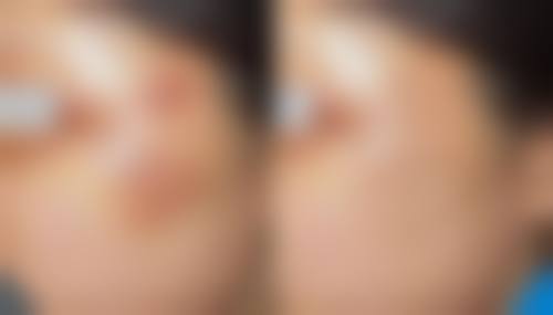 杨白兰医生技术优势