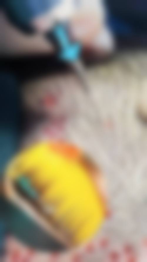 杨维玲医生预约挂号