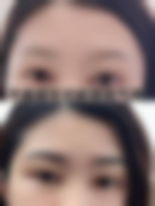 杨维玲医生技术优势