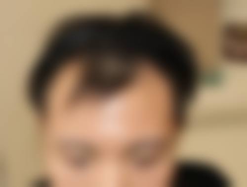 杨维玲医生项目收费价格