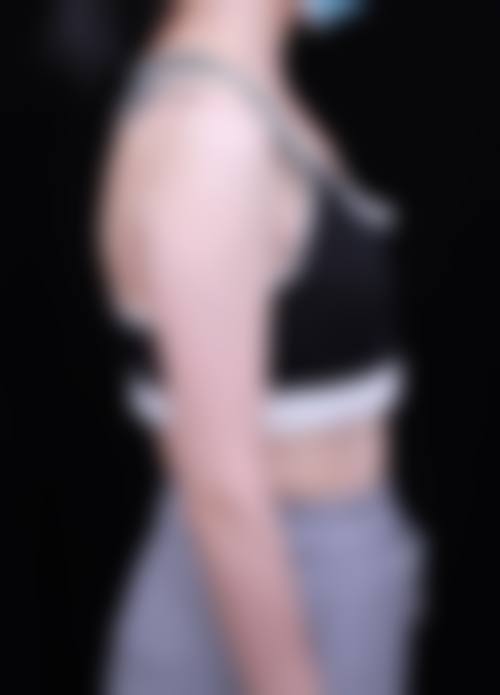 李天兴医生项目收费价格