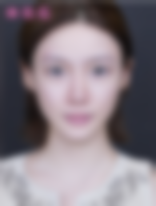 曹令医生项目收费价格