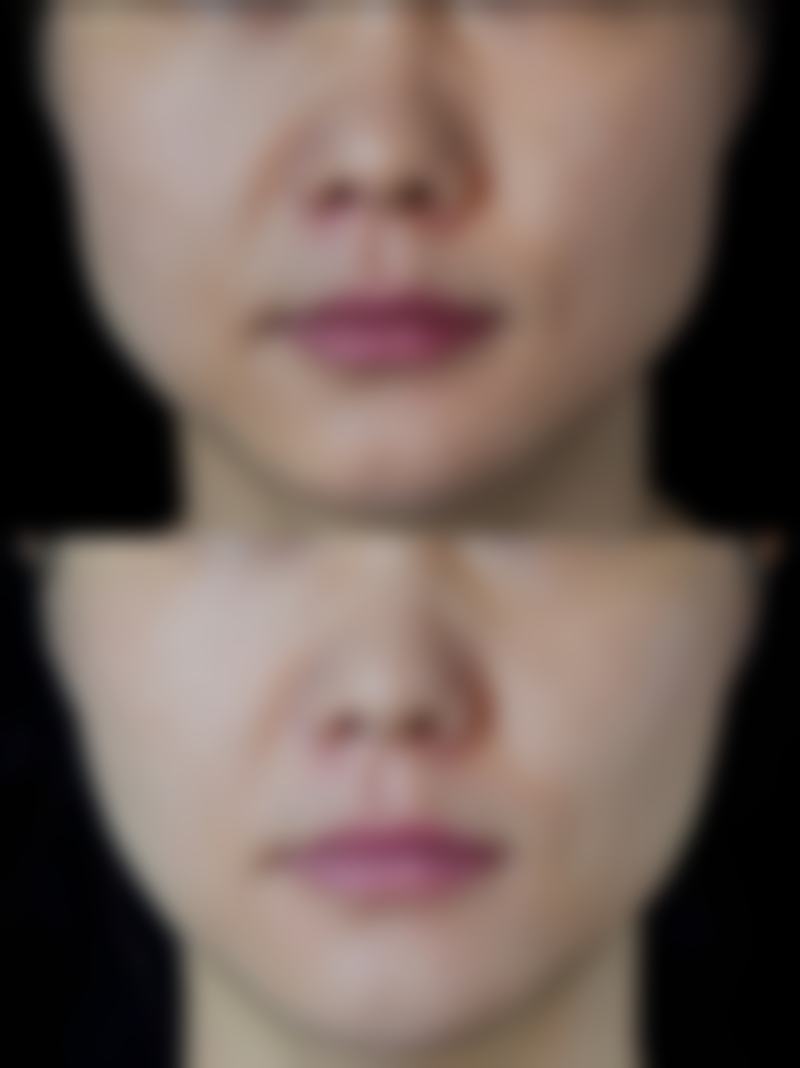 青岛诺美德美容整形门诊部收费价格表