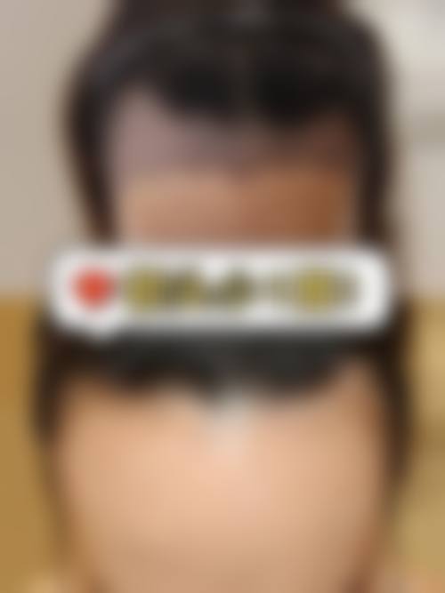 韩冬美医生技术优势