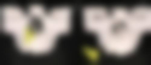 中山大学附属肿 瘤医院张嵘医生