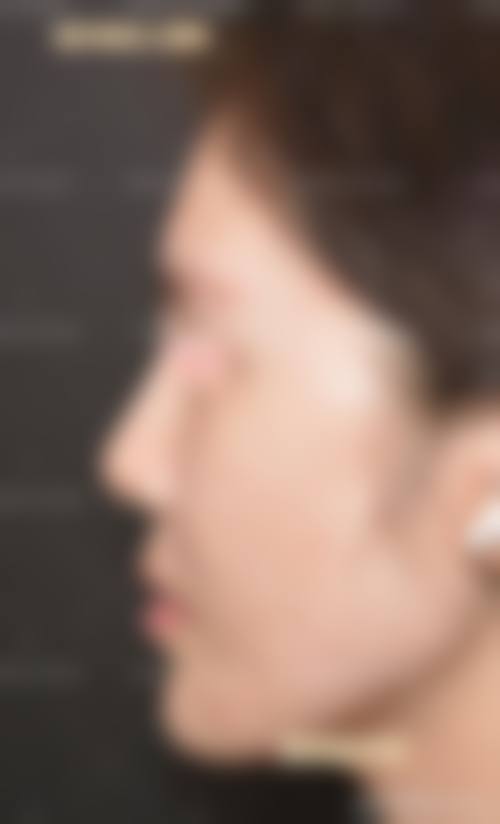 罗安丽医生技术优势