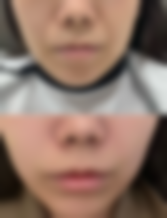 哈尔滨美佳娜医疗美容植发医院预约挂号方式