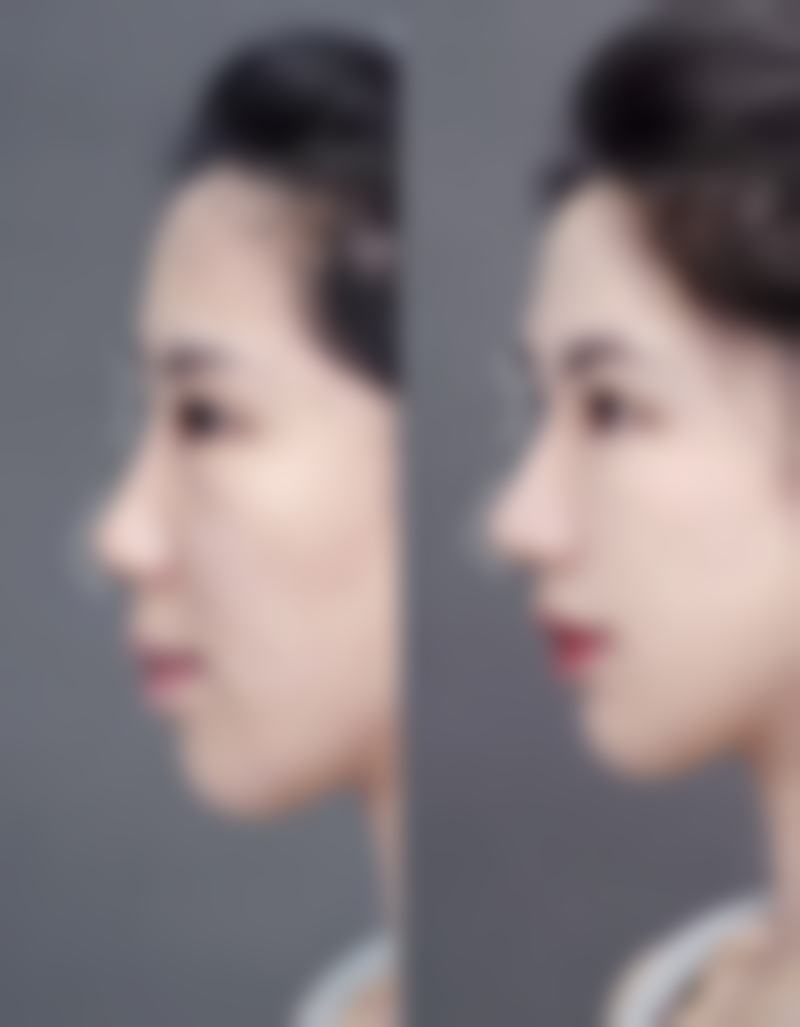 哈尔滨美佳娜医疗美容植发医院地址电话、营业时间