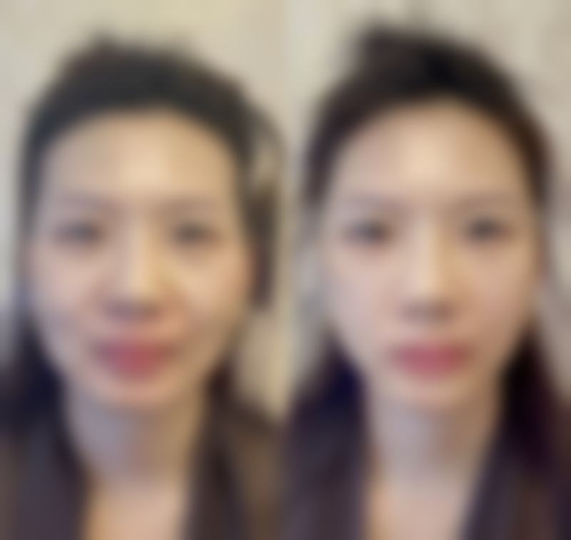 秦皇岛梵时光医疗美容诊所收费价格表