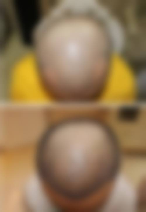 温州新生植发门诊部医生团队介绍