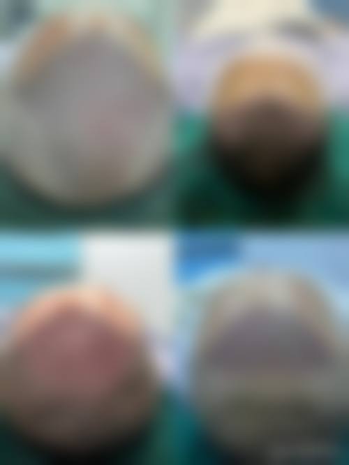 北京首都医 科 大学附属北京朝阳医院整形美容外科特色诊疗项目与技术优势