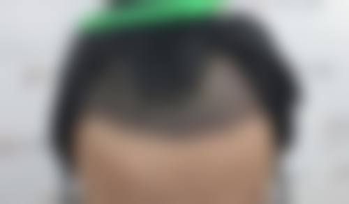 温州新生植发门诊部医疗环境与配套设施