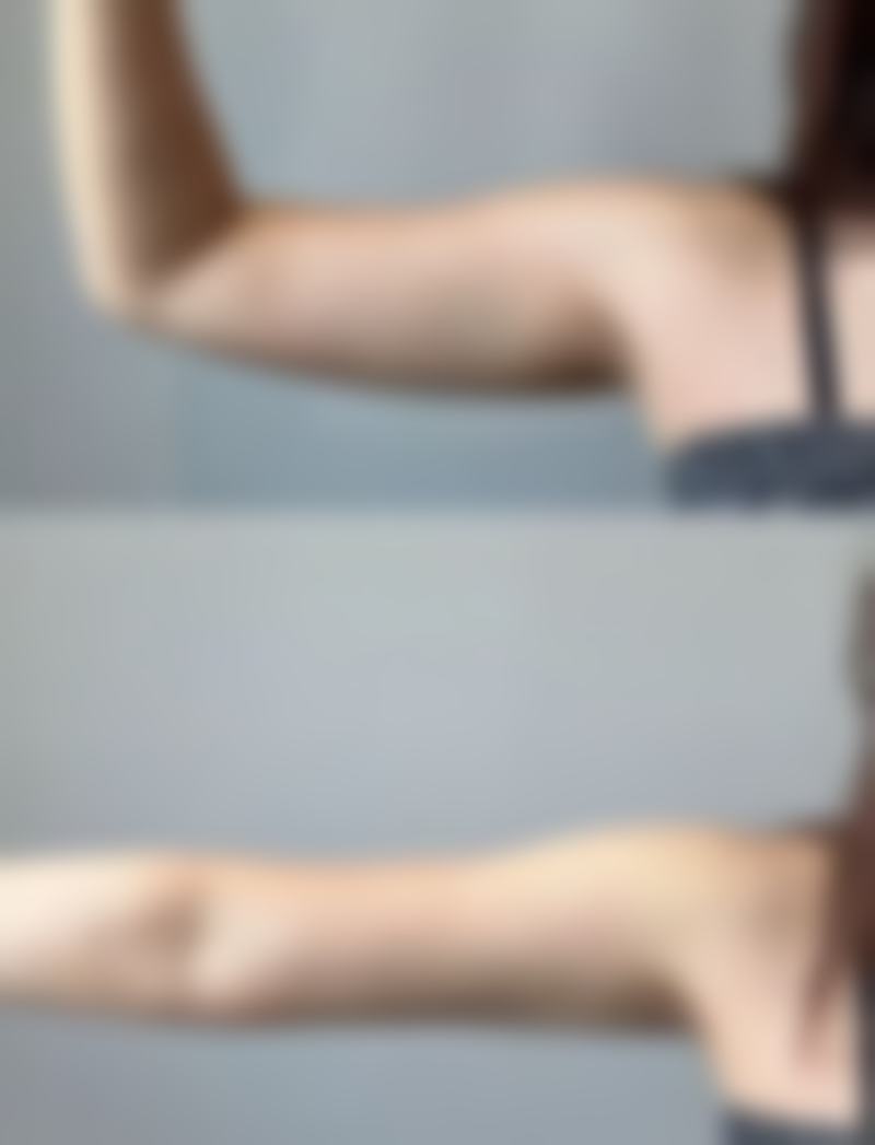 李乾镐医生技术优势