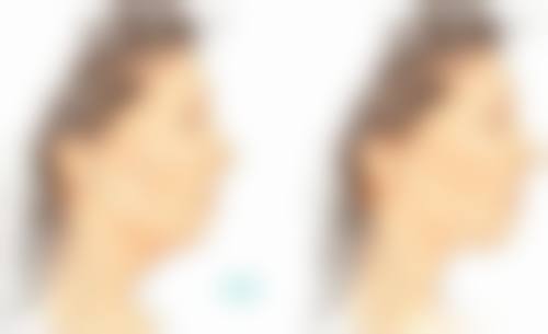 李向红医生项目收费价格