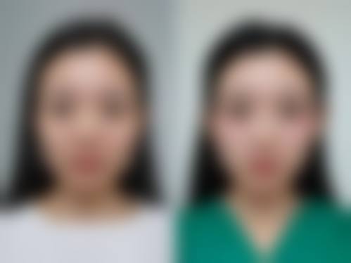 朱韶宣医生技术优势