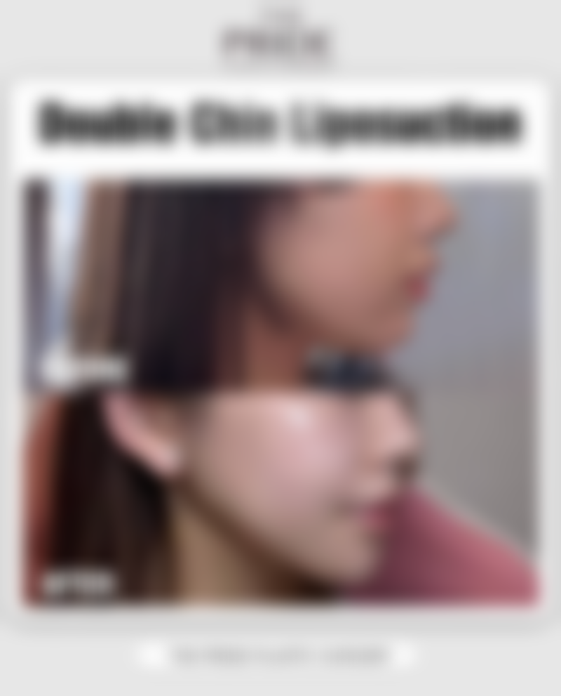 刘敏医生技术优势