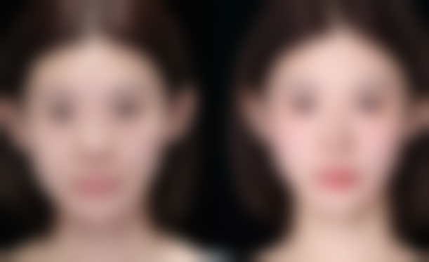 什邡雅筑伊美整形医院收费价格表