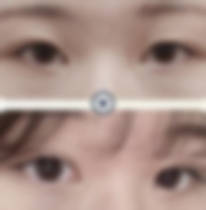 韩国Rose and整形外科收费价格表