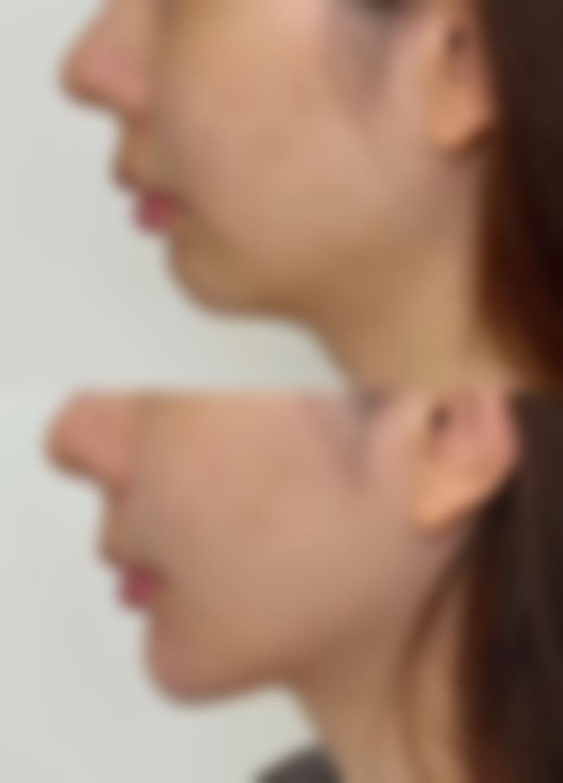 南美英医生技术优势