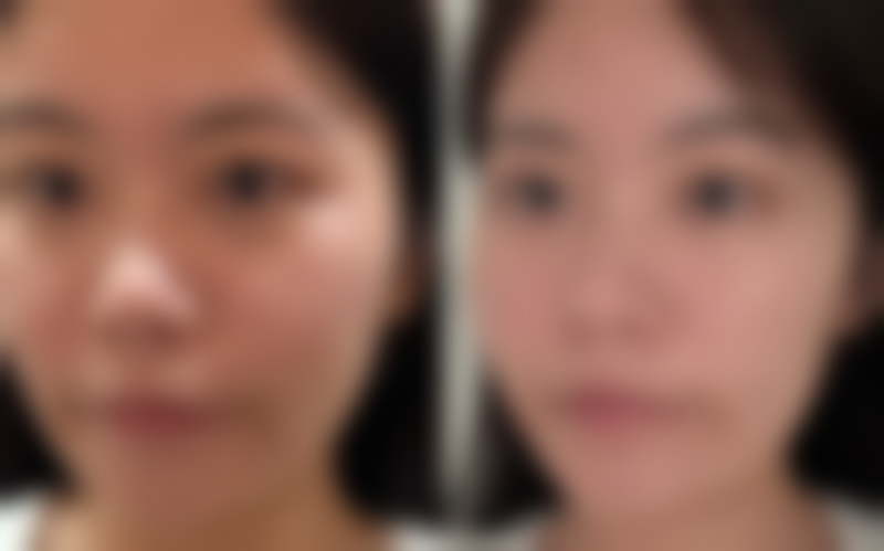 刘敏医生项目收费价格