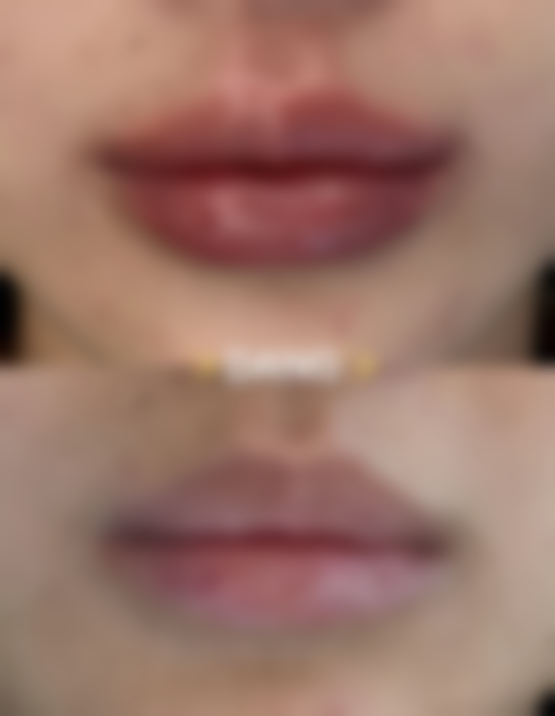 闵道元医生技术优势