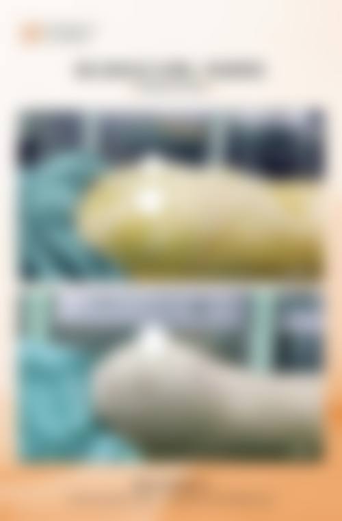 郑州大学第一附属医院整形外科收费价格表