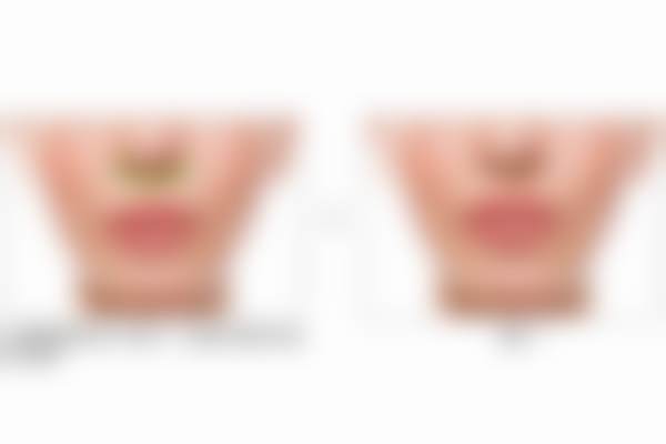 张兵医生口碑评价及反馈内容