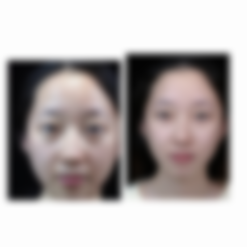 朱万春医生技术优势