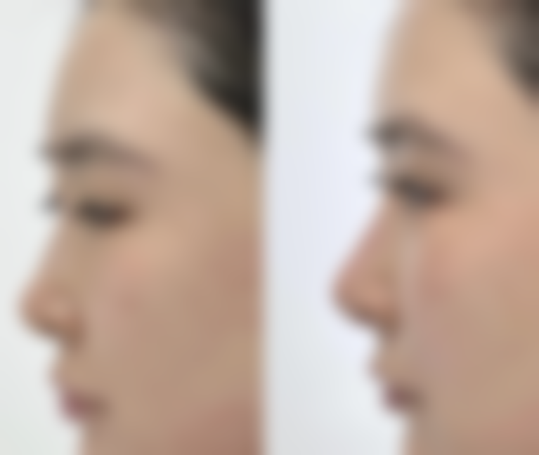 德阳德美整形医院预约挂号方式