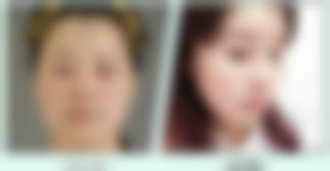 李伟民医生项目收费价格