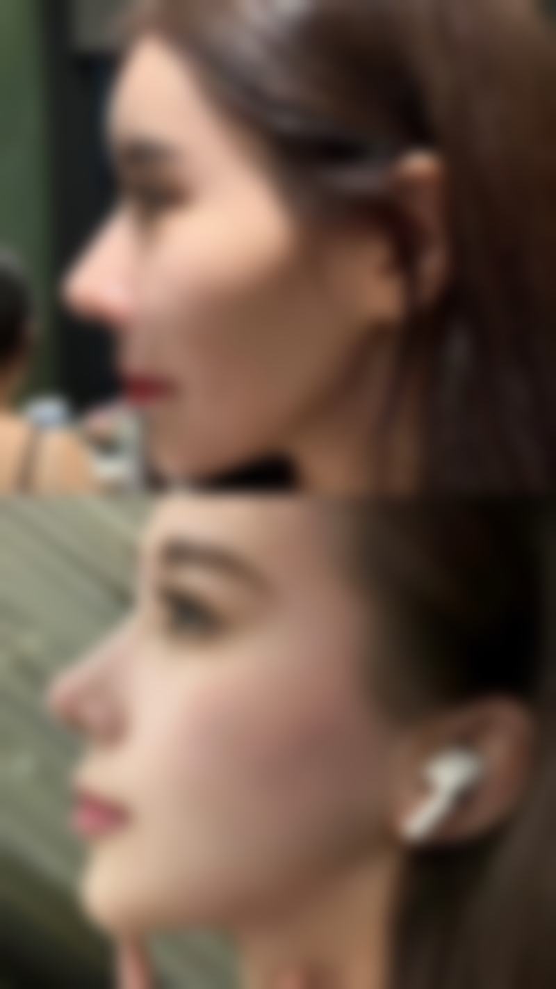 广州珈禾整形美容门诊部收费价格表