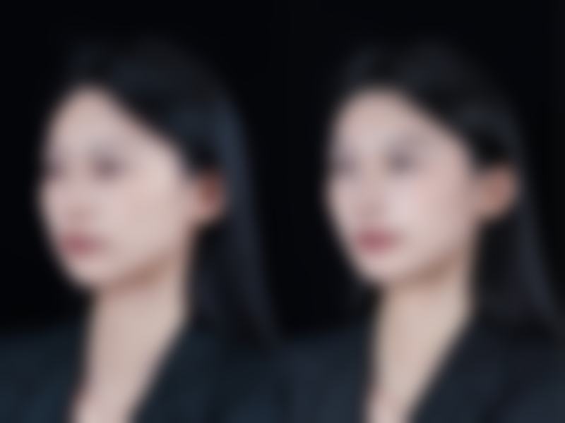 北京思美苏医疗美容医院收费价格表