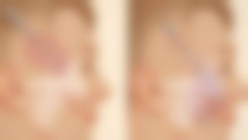 李广智医生预约挂号