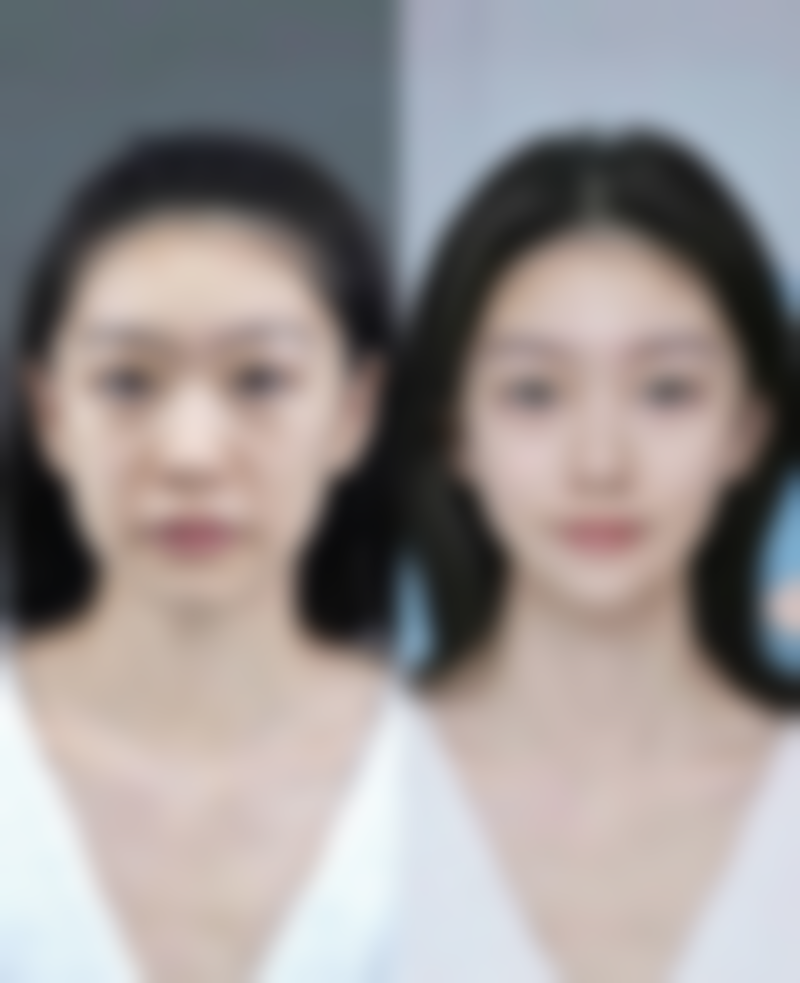 李挺医生项目收费价格