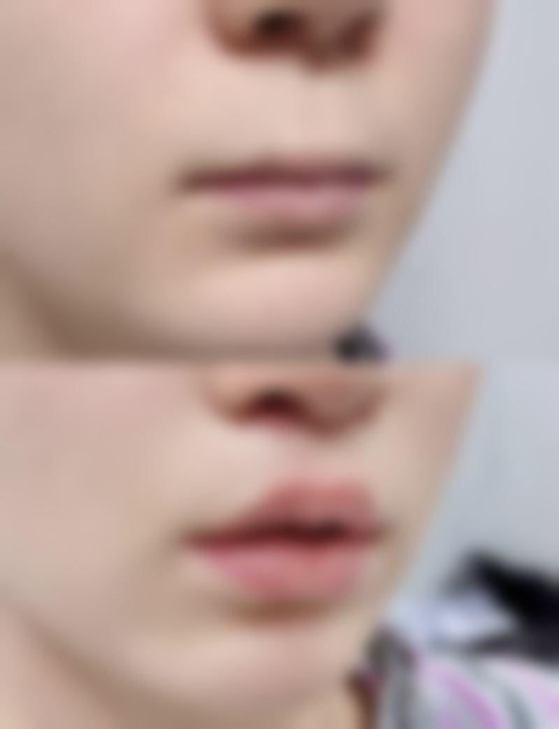 李挺医生口碑评价及反馈内容