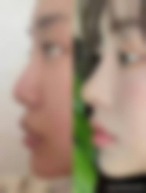 杨医生生预约挂号