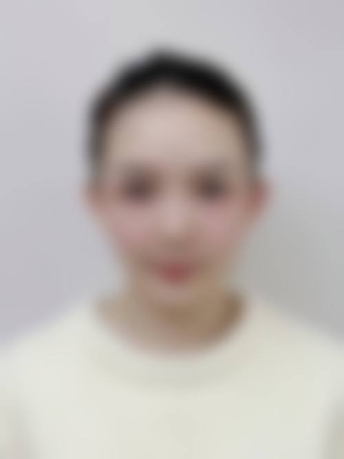 李乾镐医生技术优势