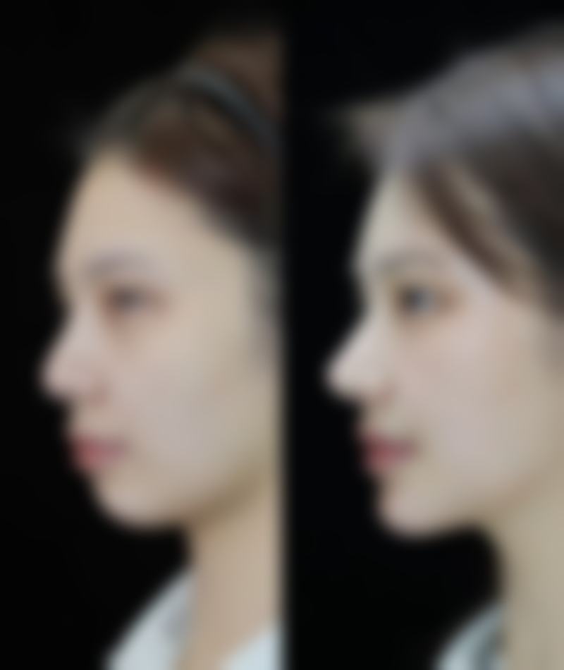 监利美加壹整形医院预约挂号方式