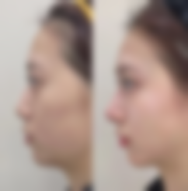 金玟智医生口碑评价及反馈内容