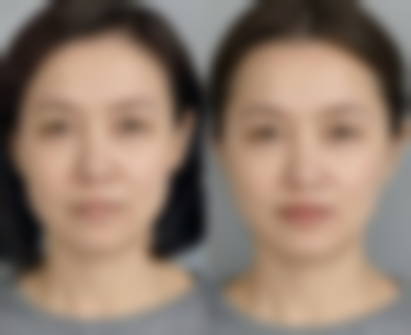 韩国艺成整形外科医疗环境与配套设施