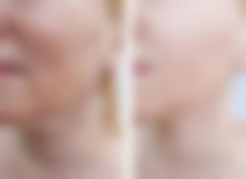 何璇医生预约挂号