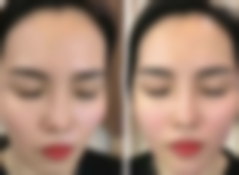 包头微缇(原铂丽)医疗美容门诊部特色诊疗项目与技术优势