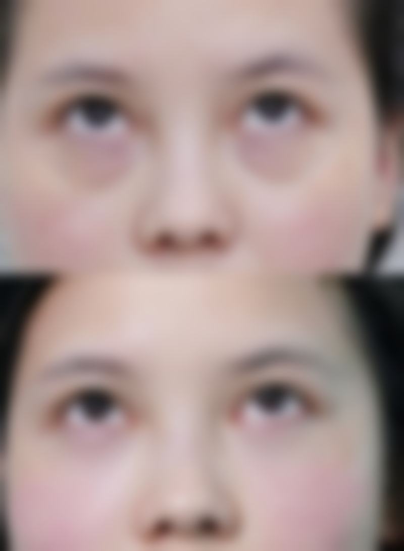 董春姬医生项目收费价格