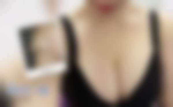 李伟民医生项目收费价格